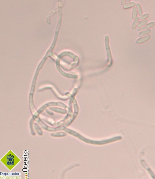 Fusarium circinatum >> Hifas estériles enroscadas (circinos) características de F. circinatum.jpg